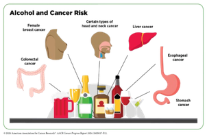 Esquema dels càncers relacionats amb el consum d'alcohol